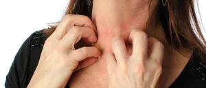 Allergies Cutanées dermatologue a fes